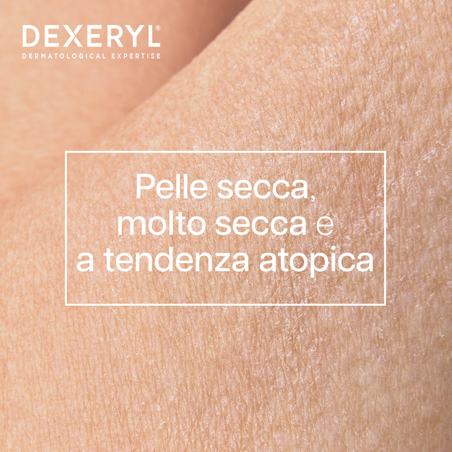 Dexeryl - Olio Lavante Antiprurito Per Pelle Secca E A Tendenza Atopica 1 Litro