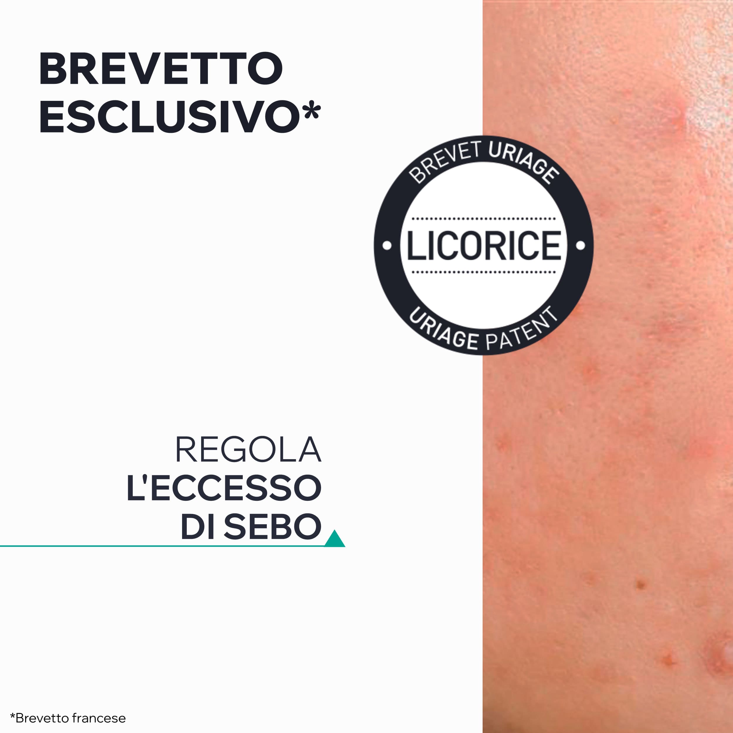 Uriage - Hyséac - Gel SOS Purificante Anti-Imperfezioni Viso 15 ml