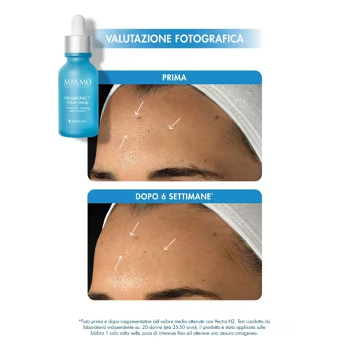 Miamo Protocollo Plump & Fill Anti-Rughe per Pelle Secca con Hyaluronic14+ Fusion Serum 30 + in Regalo Collagen Boost Intense 10 ml + Epigenage Shot