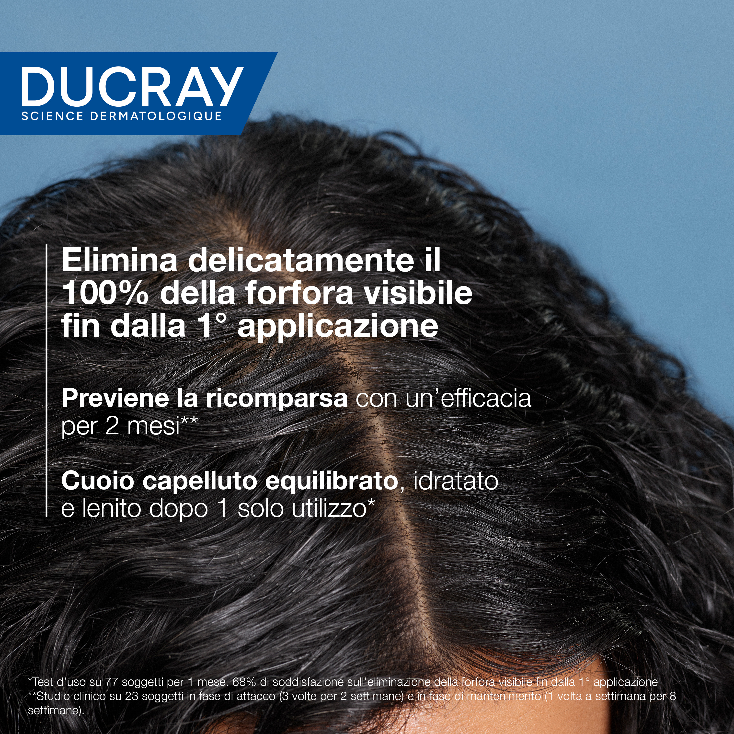 Ducray Kelual Squanorm Shampoo Trattante Idratante Forfora Secca, Elimina 100% della forfora, Azione anti-ricomparsa, Cuoio capelluto secco 400ml 