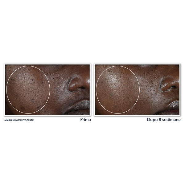 RoC Multi Correxion® Even Tone + Lift Crema Notte - 50ml