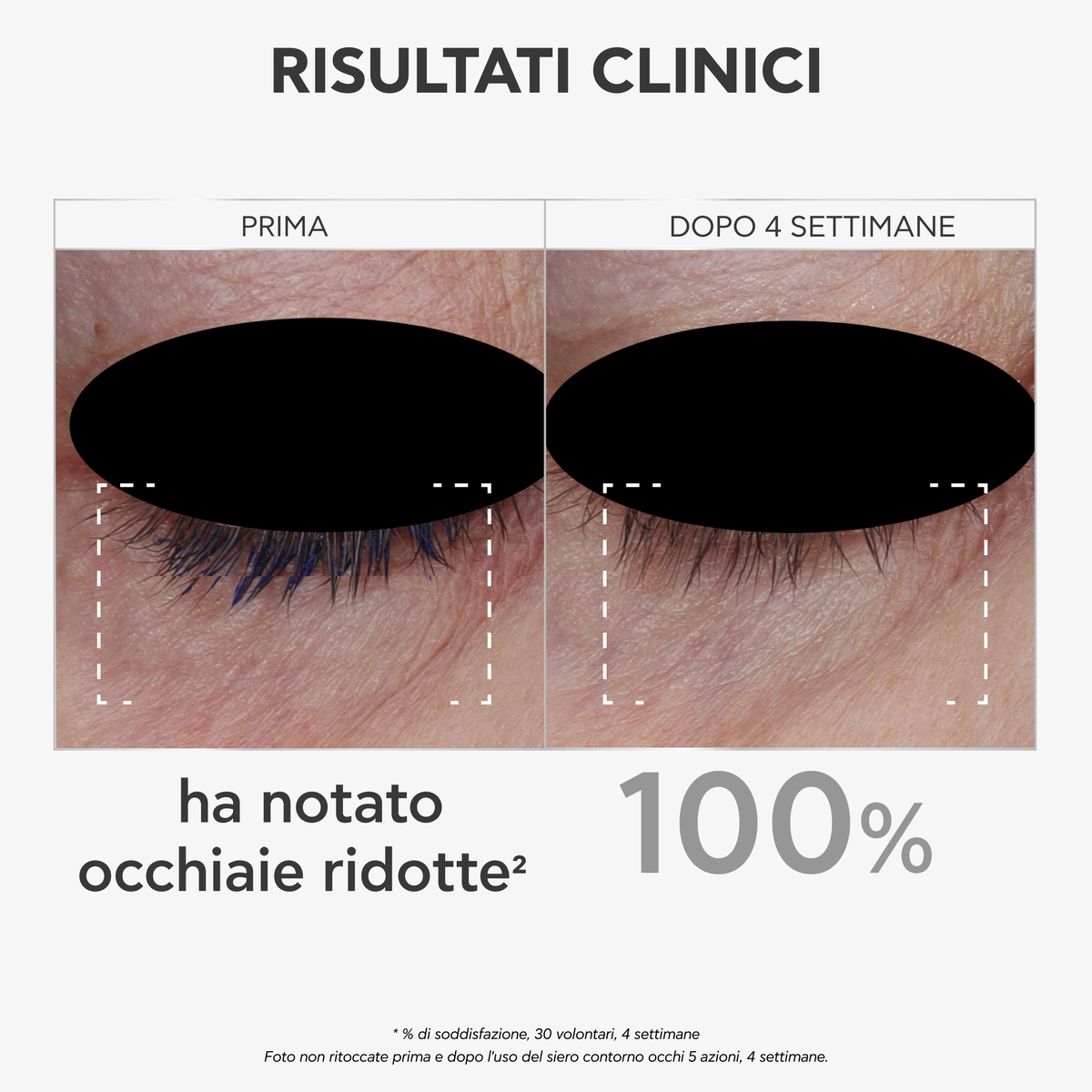 Apivita Bee Tech Concentrates - Siero Antirughe 5 Azioni Per Il Contorno Occhi 15 ml