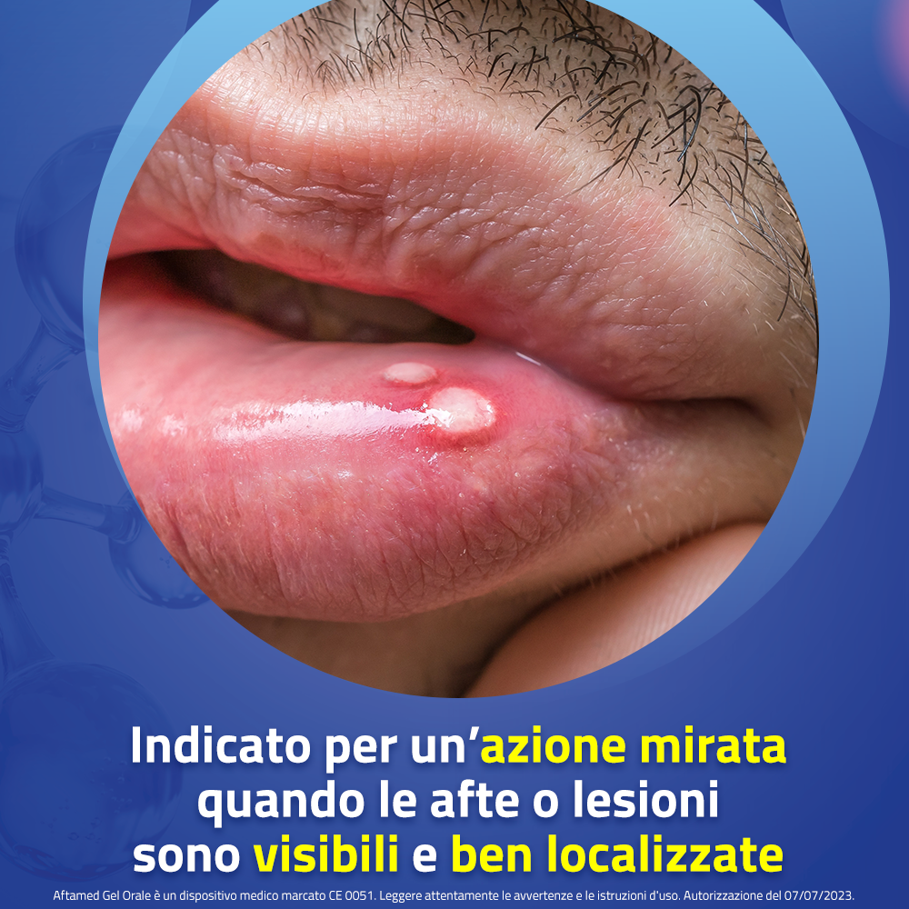 Aftamed Gel Orale Anti Afte 15 ml Aftamed Gel Orale Anti Afte 15 ml