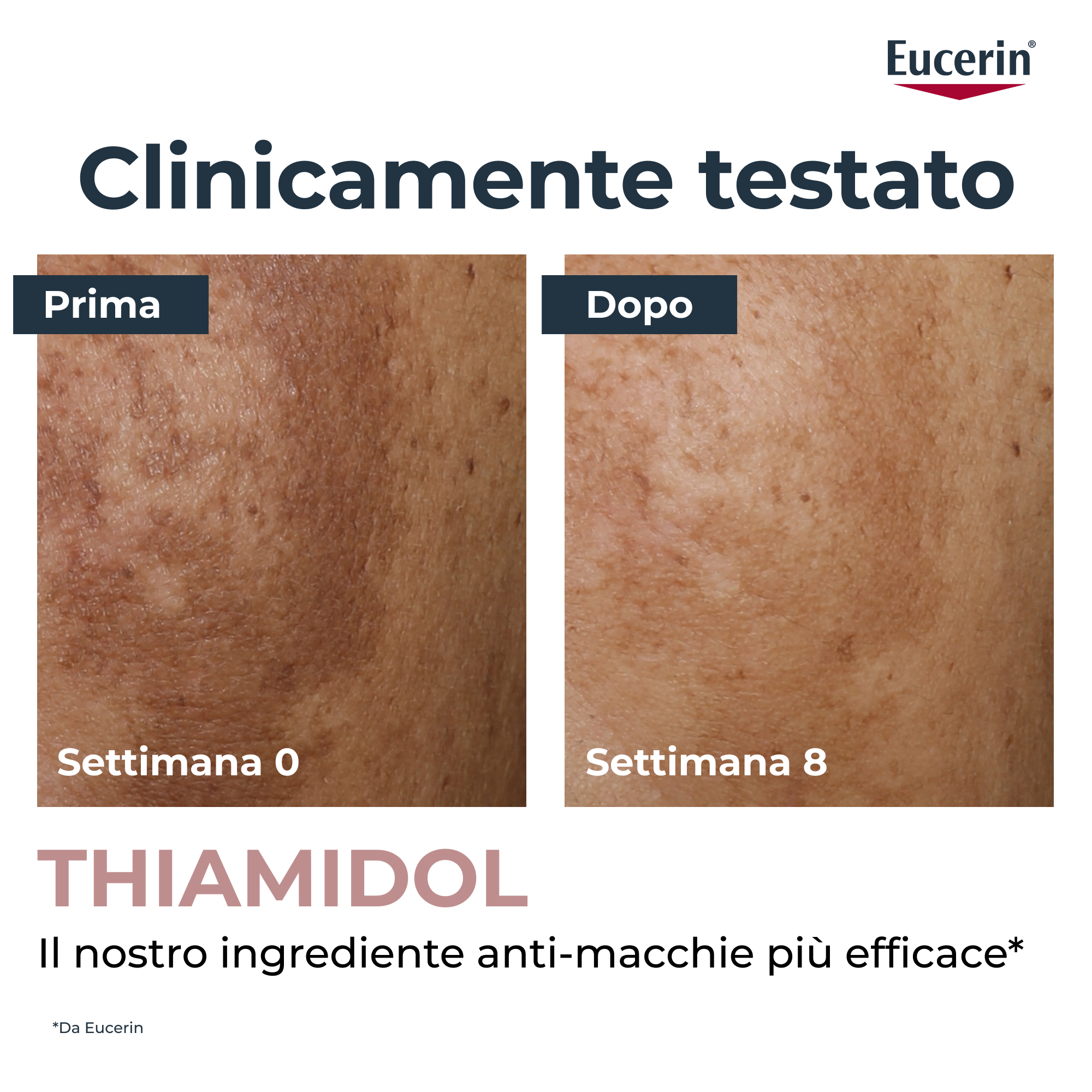 Eucerin Anti-Pigment - Crema Corpo Anti-Macchie 200 ml
