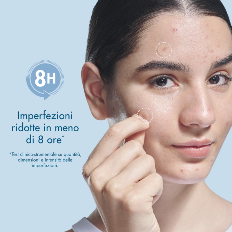 Miamo Acnever - 48 Patches Anti-Imperfezioni Per Pelle Grassa E Acneica