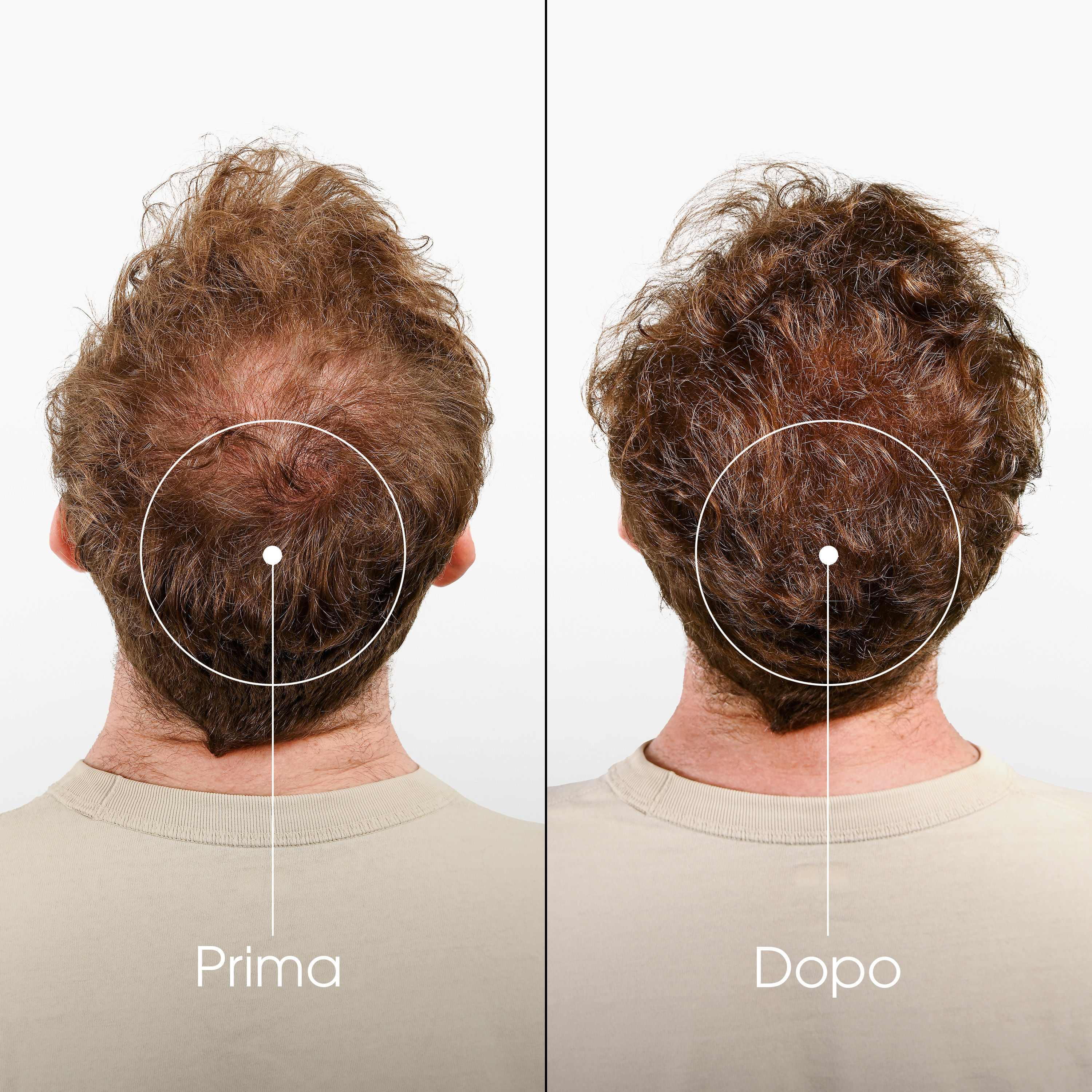 Klorane Shampoo alla Chinina E Stella Alpina Bio Caduta Capelli 200ml