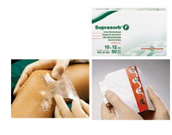 SUPRASORB F 5X7CM 10PZ
