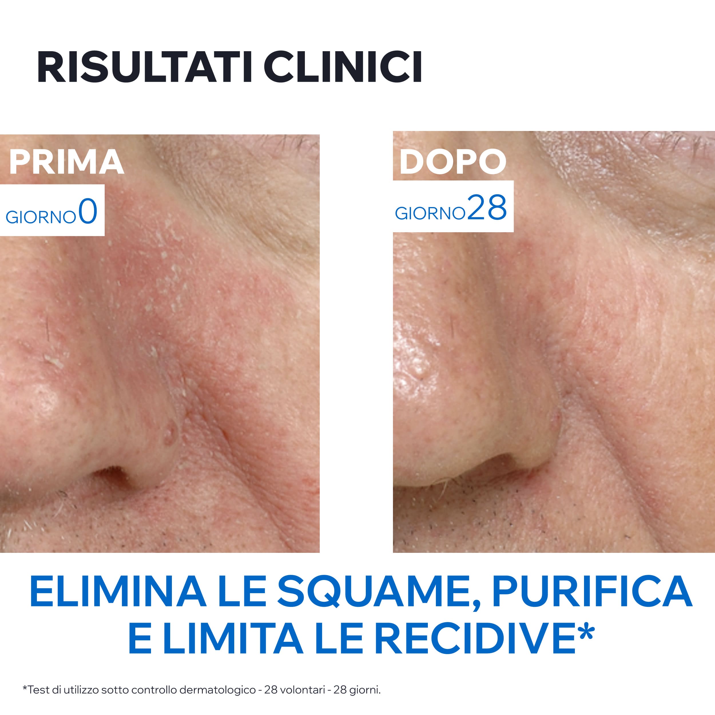 Uriage - DS Émulsion - Trattamento Regolatore Per Pelle Irritata 40 ml