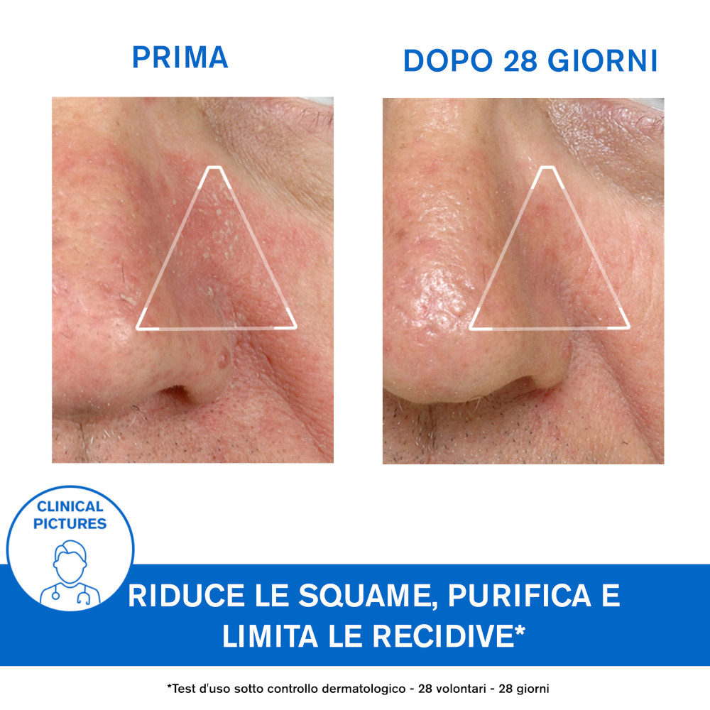 Uriage DS Emulsione Trattamento Regolatore Pelle Irritata 40 ml