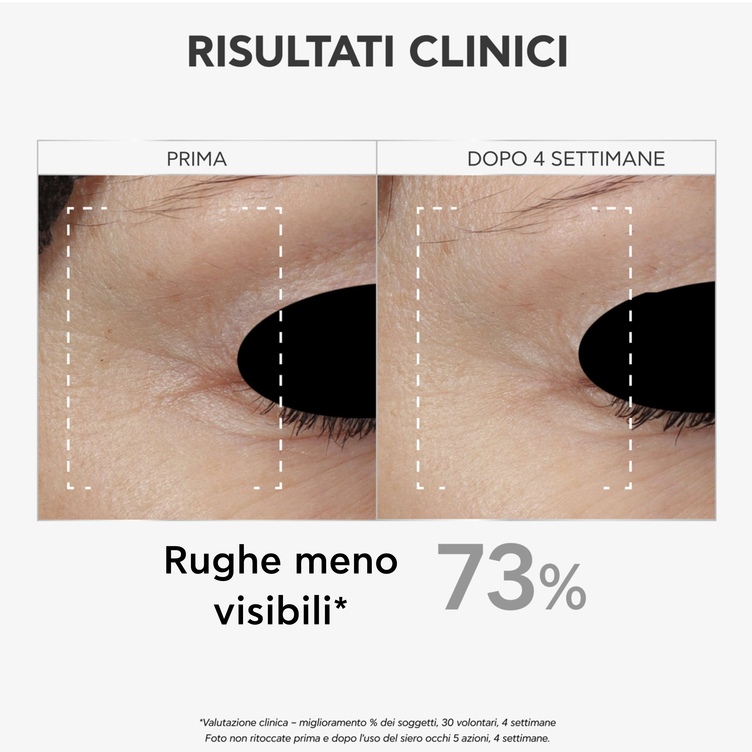 Apivita Bee Tech Concentrates - Siero Antirughe 5 Azioni Per Il Contorno Occhi 15 ml