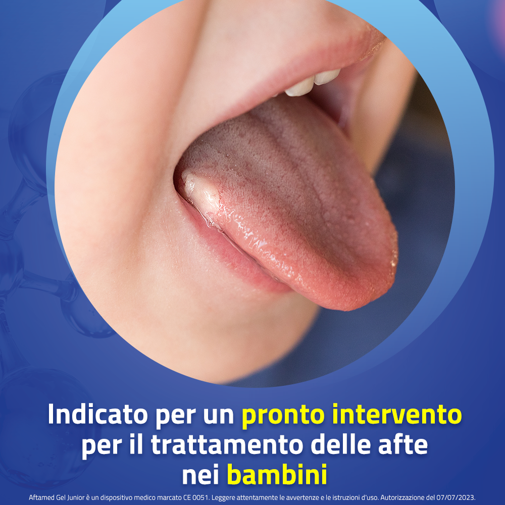 Aftamed Junior Gel Orale Anti Afte Senza Alcool 15 ml Aftamed Junior Gel Orale Anti Afte Senza Alcool 15 ml