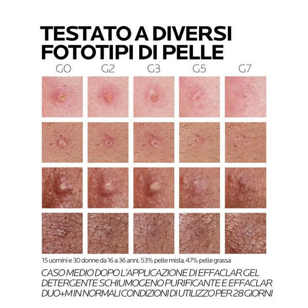 EFFACLAR DUO+M 40ml EFFACLAR DUO+M 40ml