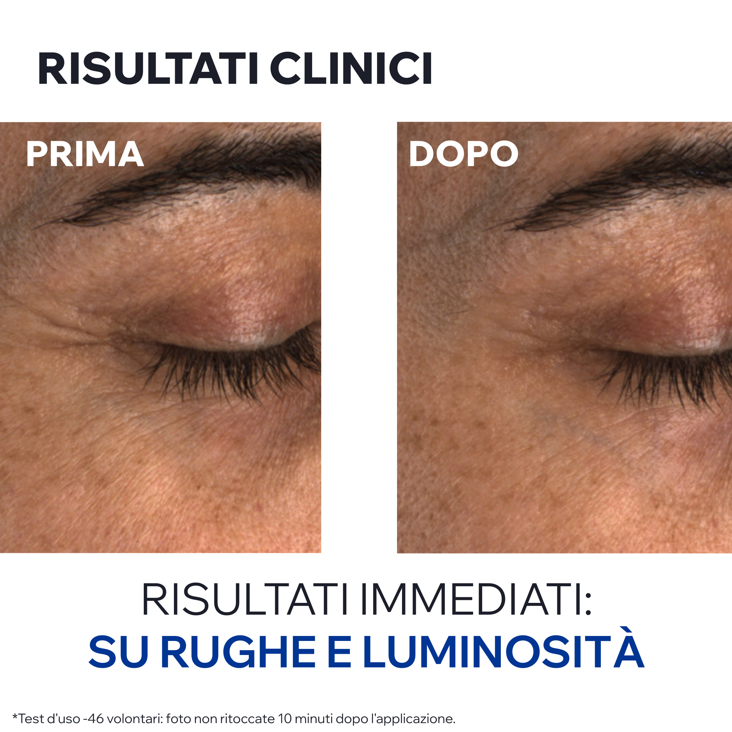 Age Absolu - Balsamo occhi perfezionatore ridensificante