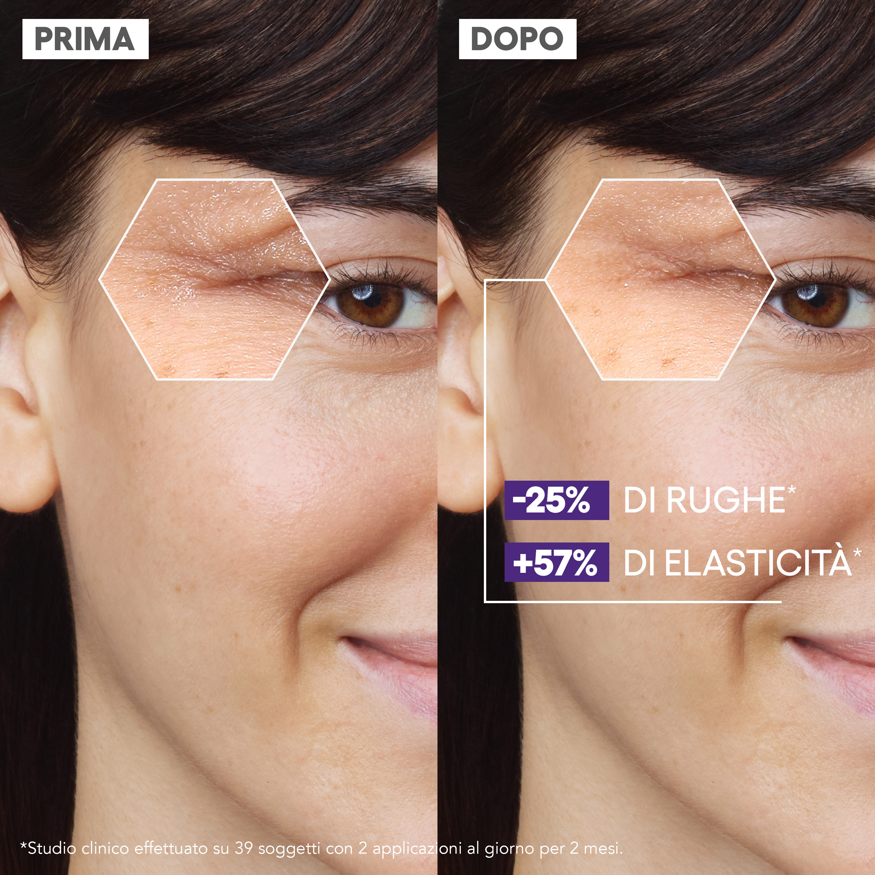 A-Derma Epitheliale Ultra Repair  Siero multi-ristrutturante, Anti-rughe, Acido Ialuronico, 30ml