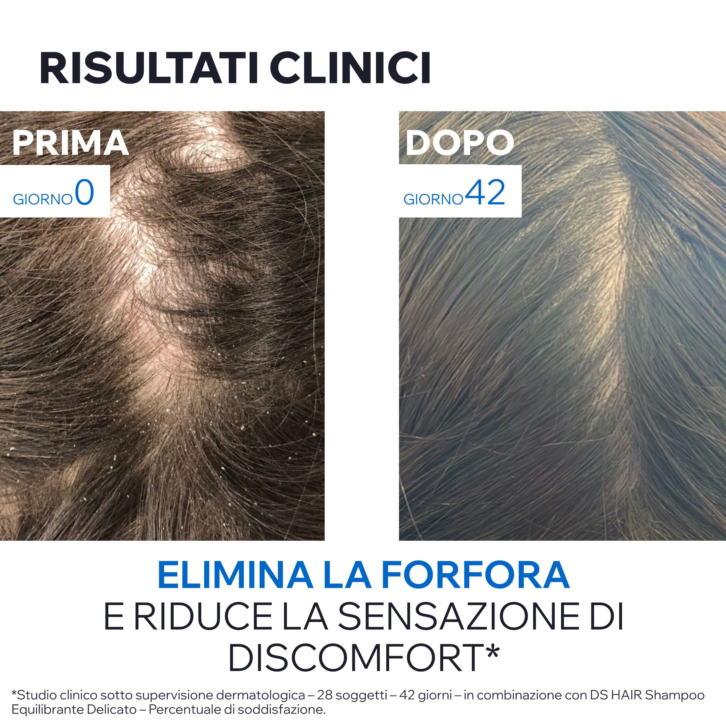 Uriage - DS Hair - Shampoo Antiforfora 200 ml