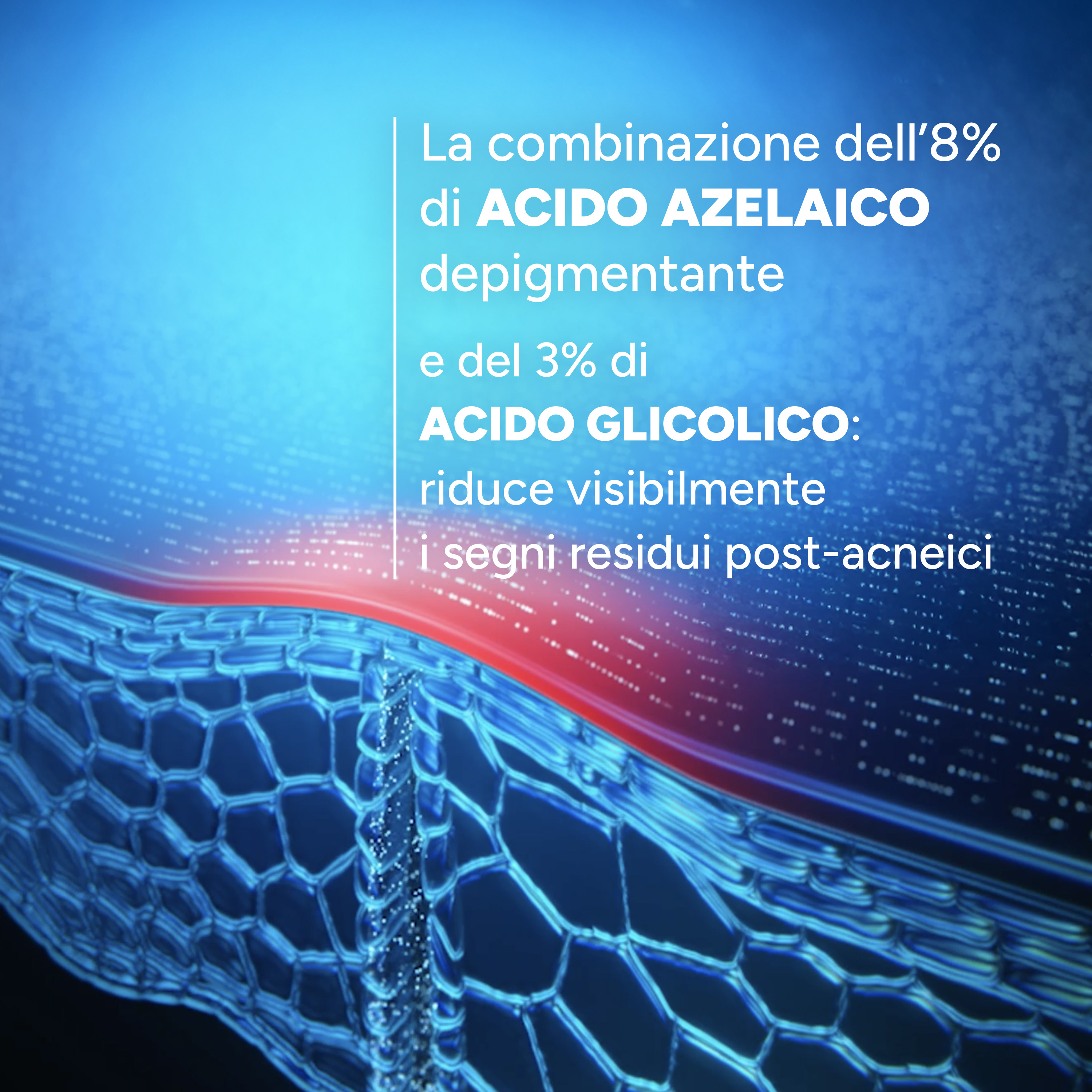 Ducray Keracnyl - Siero Regolatore Anti-Imperfezioni Per Pelle Acneica 30 ml